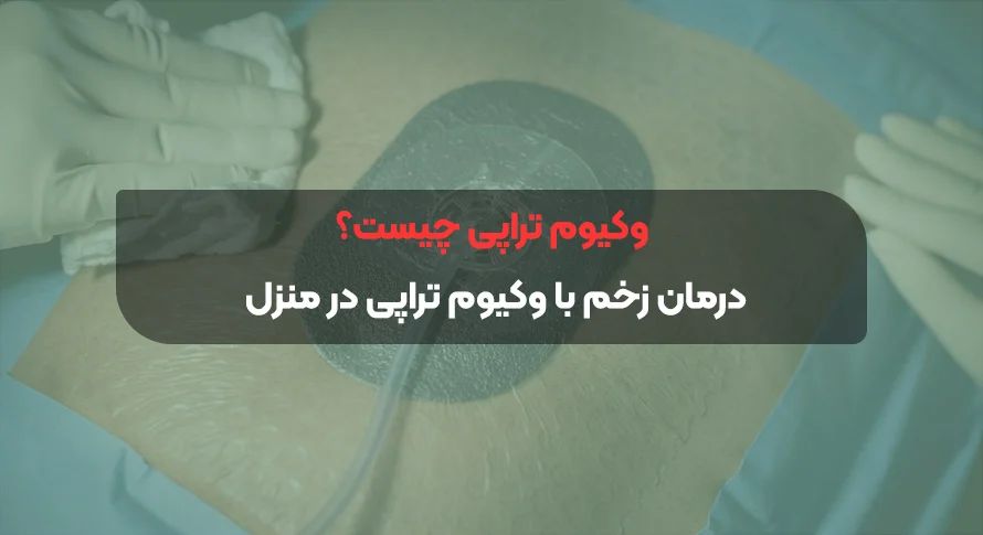 وکیوم تراپی چیست؟ | درمان زخم با وکیوم تراپی در منزل مشهد