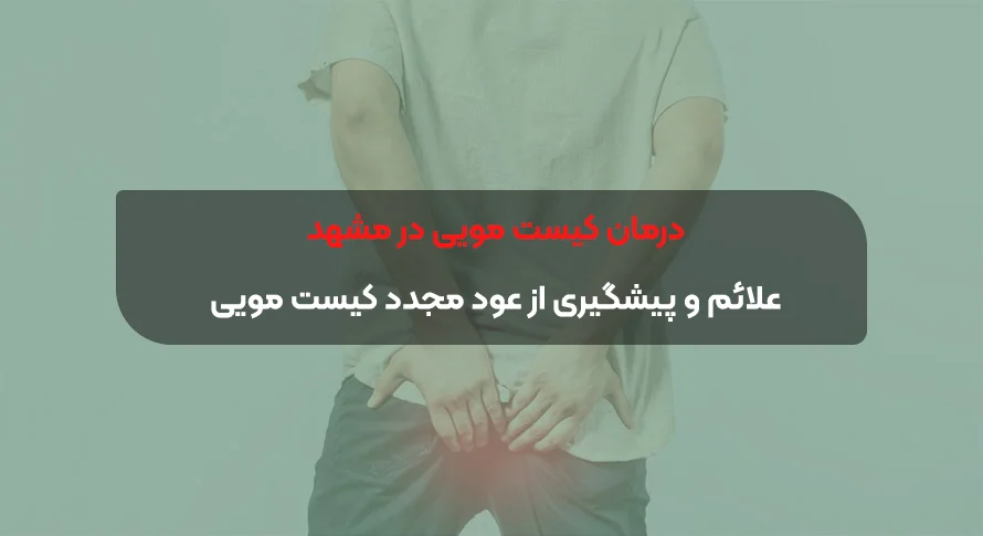 درمان کیست مویی در مشهد – علائم و پیشگیری از عود مجدد کیست مویی